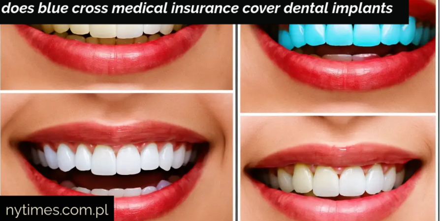 does blue cross medical insurance cover dental implants​ 2025